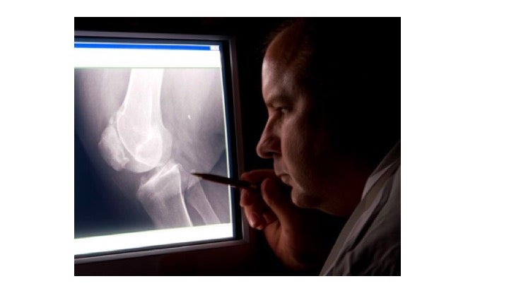 Radiologist examining an x-ray