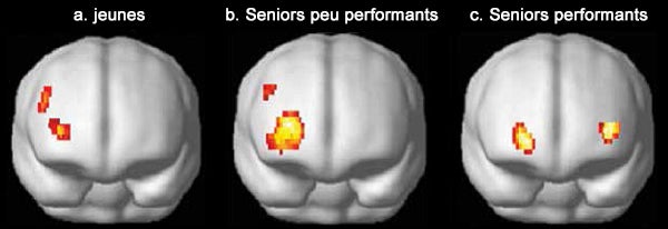 Cerveaux. Productivité des jeunes et des seniors. Blog de la Banque mondiale